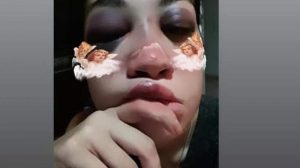 San Francisco: Fue detenido por meterse en la casa de su ex novia durante la madrugada y darle una feroz golpiza